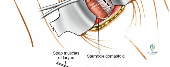 Clinical Image