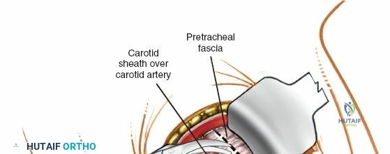 Clinical Image