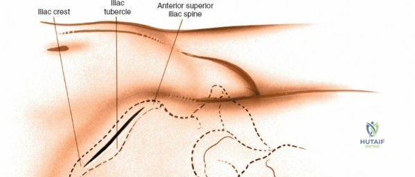 Clinical Image