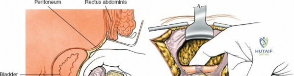 Clinical Image