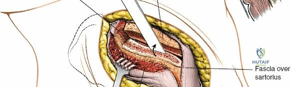 Illustration of sacroiliac joint anterior - Dr. Mohammed Hutaif