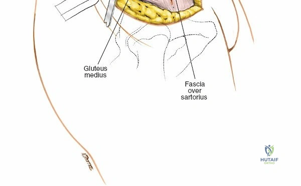 Clinical Image