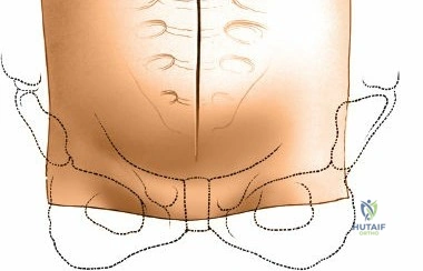 Clinical Image