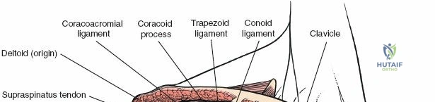 Clinical Image