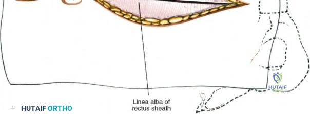 Clinical Image