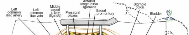 Clinical Image