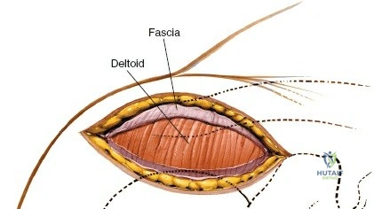 Clinical Image