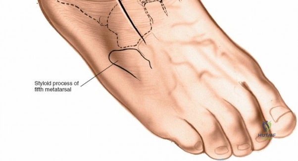 Clinical Image