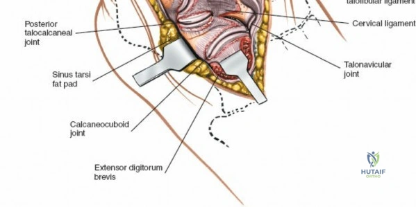 Clinical Image