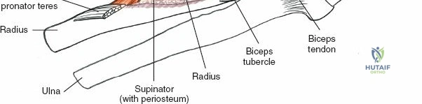 Mastering the Anterolateral Approach to the Elbow: Anatomy & Surgical Applications