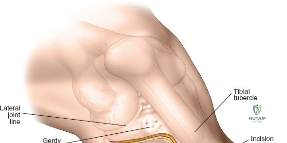Clinical Image