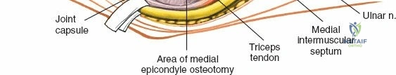 Clinical Image