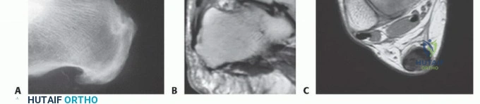 Principles of Foot and Ankle Surgery: Tourniquets, Instrumentation, and Regional Anesthesia