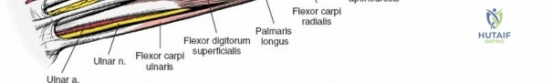 Unlock the Anterior Compartment of the Forearm: Surgical Keys