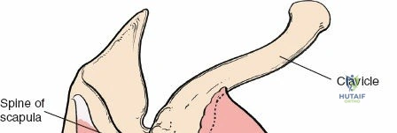 Illustration of anterolateral and lateral - Dr. Mohammed Hutaif