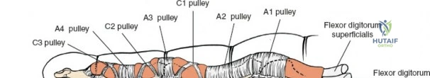 Illustration of finger flexor tendons - Dr. Mohammed Hutaif