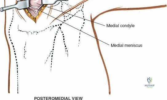 Clinical Image