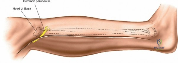 Comprehensive Guide to Extensile Surgical Fibula Access: Anatomy, Approaches & Indications