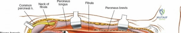 Clinical Image