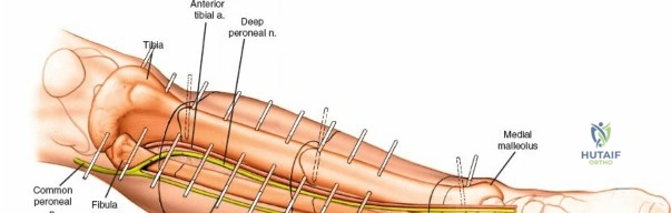 Clinical Image