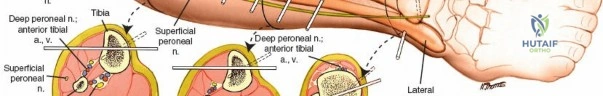 Clinical Image