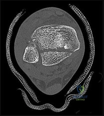 Master Orthopedic Approaches: SAESN Preferred Response Guide