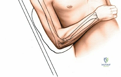 Clinical Image