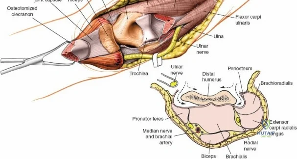 Clinical Image