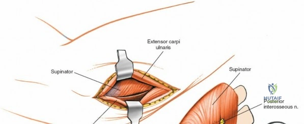 Clinical Image
