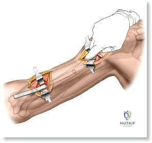 Clinical Image
