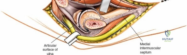 Clinical Image