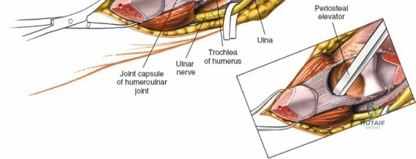 Clinical Image