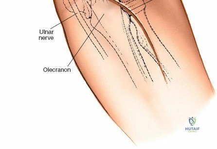 Clinical Image