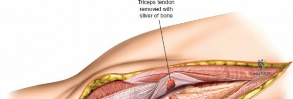 Clinical Image