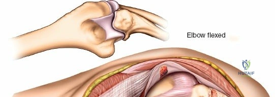 Clinical Image