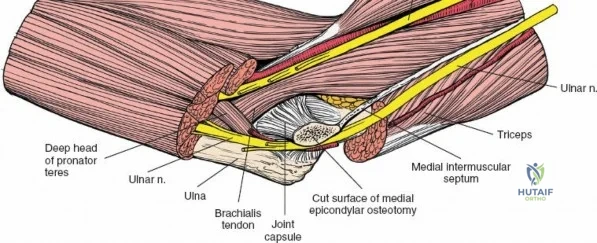 Clinical Image