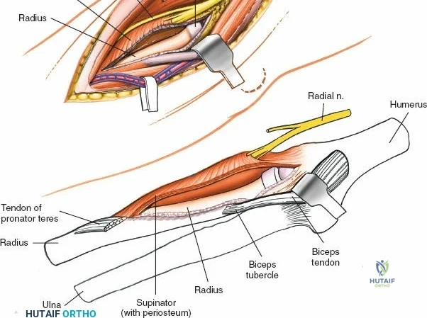 Clinical Image