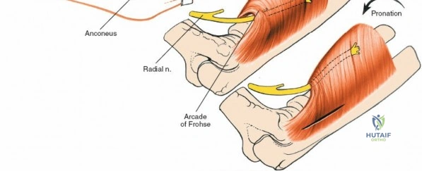 Clinical Image