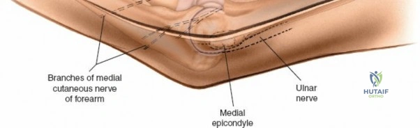 Clinical Image