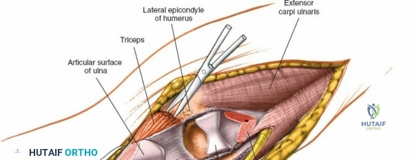 Clinical Image