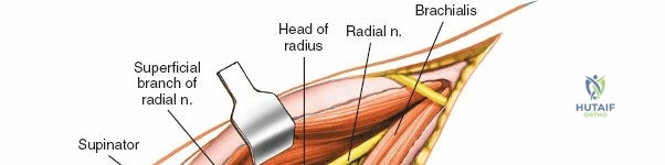 Clinical Image