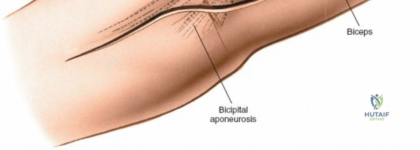 Clinical Image