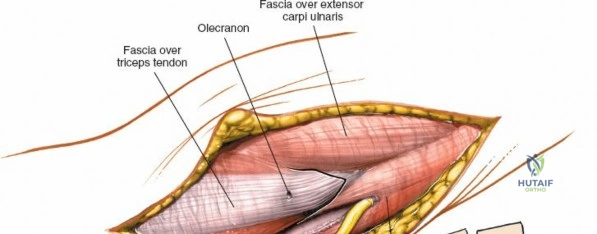 Clinical Image