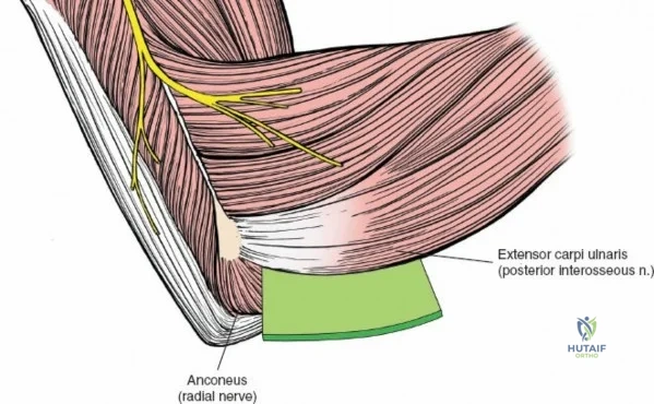 Clinical Image