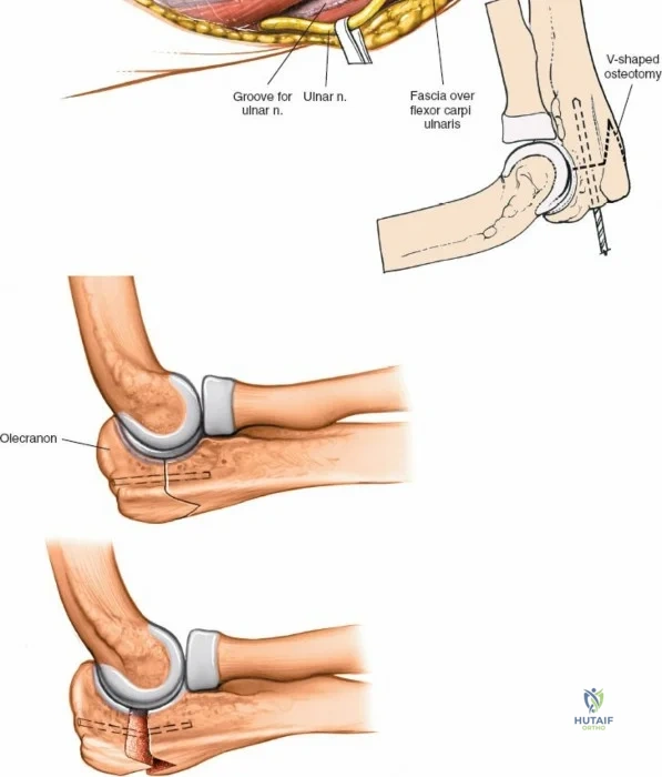 Clinical Image