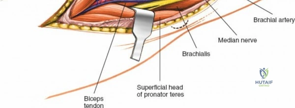 Clinical Image