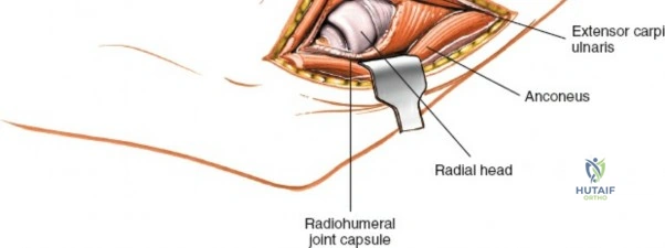 Clinical Image