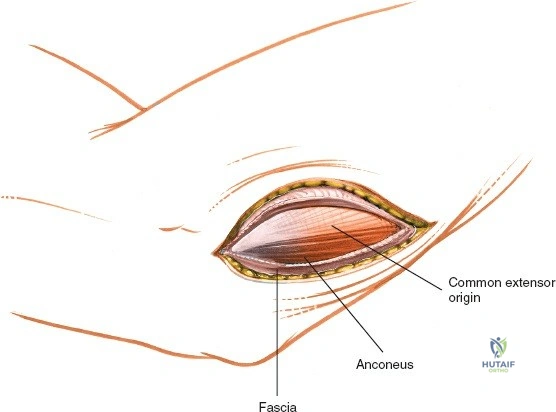 Clinical Image