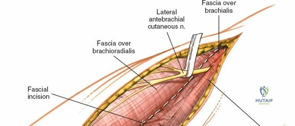 Clinical Image