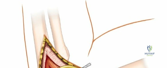 Clinical Image